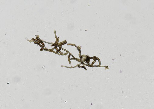 soil microorganisms under a microscope including amoeba, flagellates, nematodes, fungi, bacteria	
