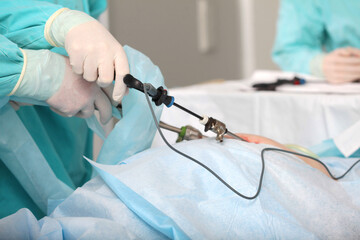 Laparoscopic instruments in hands of surgeon. Modern abdominal surgery. Laparoscopy in...