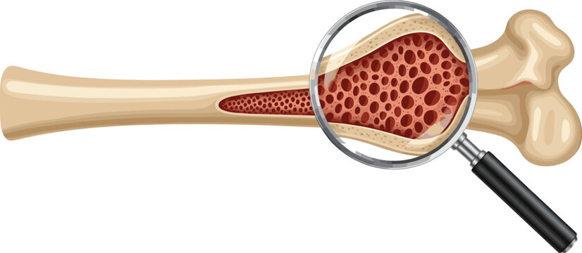 Human Bone Anatomy with Magnified Osteoporosis Structure Vector Illustration Isolated on White Background for Medical and Healthcare Education