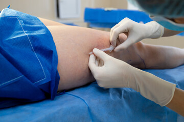 Vascular specialist performing leg vein injection.