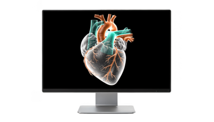 heart model showing cardiac CT reconstruction with common arterial trunk highlighted in vibrant color displayed on a radiology workstation against a clean white background.