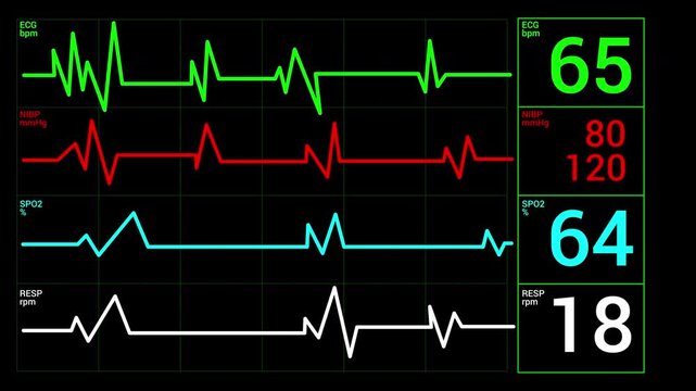 Cardiograph recording monitor with ecg, heart rate, oxygen saturation readings. Suitable for medical presentations, health articles or hospital brochures.