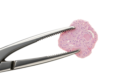 Medical Tweezers Holding a Pink Biological Tissue Sample forceps surgical