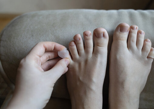 Silicone toe sleeve or cap. Woman puts on protective cover on little toe. Fights corns, prevents blisters and ingrown toenails