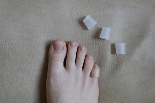 Silicone toe sleeve or cap. Woman puts on protective cover on little toe. Fights corns, prevents blisters and ingrown toenails