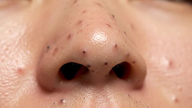 Close-up of a human nose with noticeable pores and imperfections