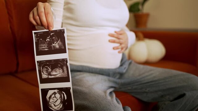 Expectant mother sitting on a cozy couch, holding sonogram pictures of her unborn baby while gently caressing her pregnant belly, cherishing the moment of future motherhood in her living room