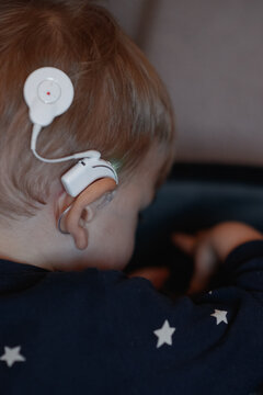 Close-up of a young child wearing a cochlear implant. Hearing healthcare technology for children, medical support and inclusive life concept.