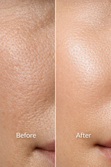 Fototapeta premium Skin texture closeup portrait aging face pores vs after skincare collagen boost smooth glow result