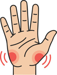 Fototapeta premium Medical vector illustration of an open human palm featuring red circular zones and radiating lines to indicate localized pain, inflammation, swelling, or symptoms of carpal tunnel syndrome and arthrit