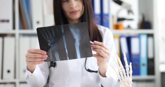 Woman doctor in white coat holds patient X-ray of injured wrist. Medical specialist studies fracture image planning treatment strategy in clinic
