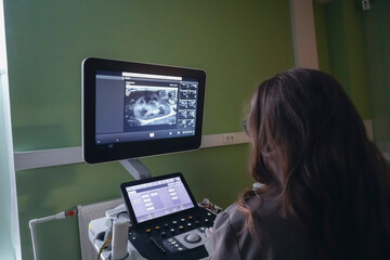 Female doctor performs an ultrasound examination, analyzing the patient's internal organ scan on a modern medical monitor.