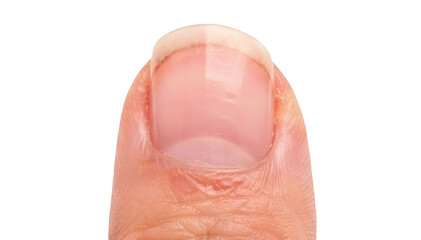 Fototapeta premium Closeup photo of a single fingernail showing gradual thickening and curvature isolated on white background highlighting natural nail growth changes over time.