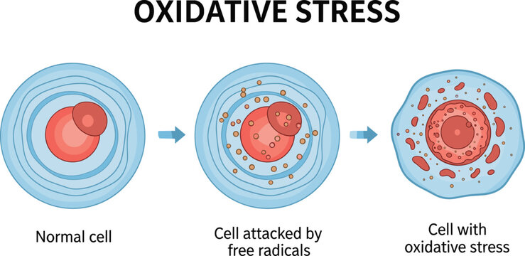 Oxidative stress cell stages, free radical damage, normal to inflamed cell anatomy, medical health concept &ndash; flat vector illustration