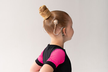 Child head with cochlear implant hearing aid