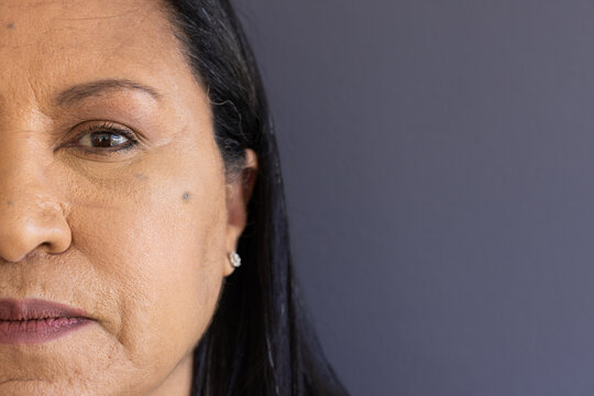 Senior female posing in studio, showing left face with mole and silver stud earring