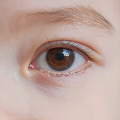 Baby with pink eye infection (close-up, detailed)