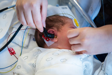 Newborn baby receiving a hearing screening test by medical professional in a hospital, assessing infant auditory health and developmental well-being at early age © batuhan toker