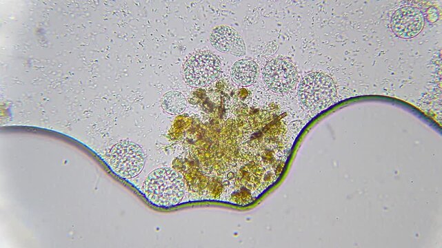 Ciliated protozoa inside cysts surrounded by large amounts of bacteria under 400x brightfield microscopy. Detailed 4k microscopic view of microbial interaction