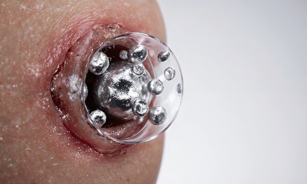 Silver antibacterial Transparent wound showing silver killing bacteria, antimicrobial action visible, medical application demonstrated, microscopic battle view, silver bullets