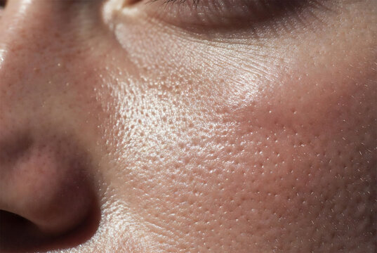 pores, pore care, enlarged pores, skin texture, sebum, oil control, pore cleansing, smooth skin, tightening, clear skin, blackheads, whiteheads, pore minimizing, refined pores, visible pores, clogged 