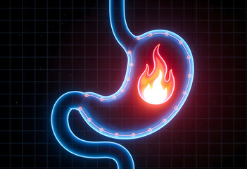 Neon representation of painful burning sensation within digestive system due to intense burning stomach