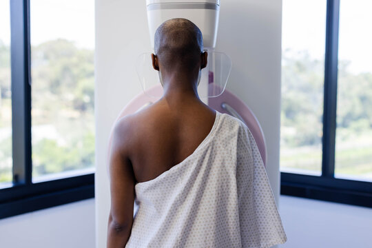 Patient is standing at mammography unit near window, gown sliding off right shoulder