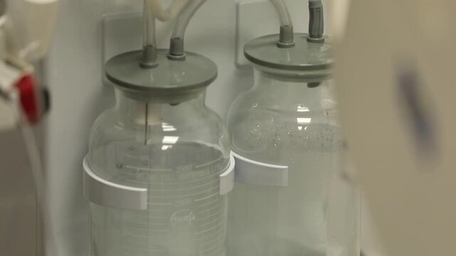 Close-up of a modern anesthesia machine ventilator working in an operating room. Medical equipment details with moving bellows and tubes during surgery in a hospital.

