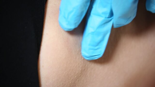 Extreme close up view of a small skin tag or papilloma on human skin. Detailed texture of the dermis with pores and fine hair visible near black clothing.

