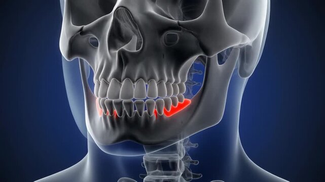 Medical 3D illustration of human skull showing painful red highlighted mandible bone.