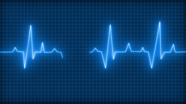 Digital representation of an electrocardiogram ECG showing heartbeats on a grid background