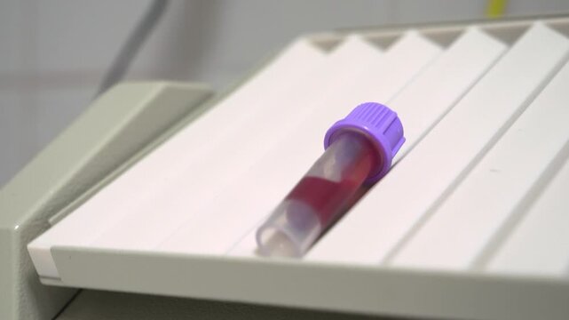 Blood Sample Mixer in a Hematology Tube in a Veterinary Clinic