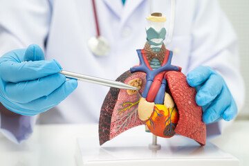 Pneumonia, lung cancer, Asian doctor holding human model.