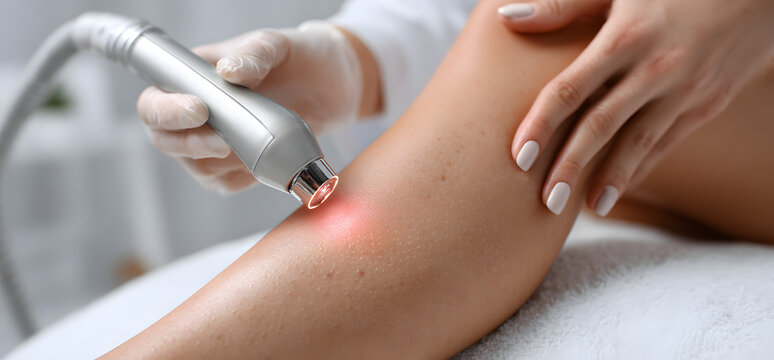 Laser hair removal on female leg for smooth skin treatment. Beauty care procedure epilation, depilation in salon banner