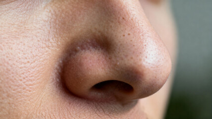 Closeup Macro of Enlarged Pores on Nose for Skin Analysis