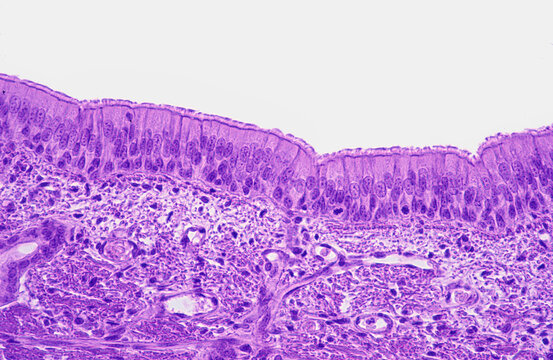 Ciliated pseudostratified epithelium