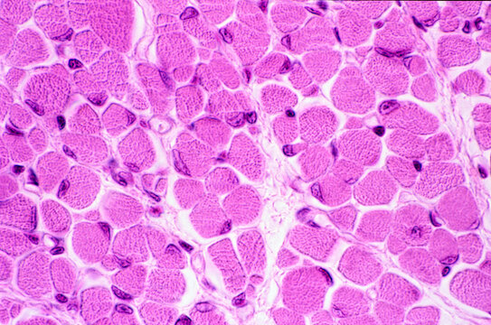 Striated muscle fibers