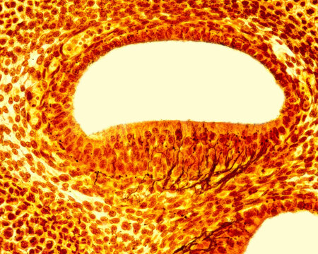 Inner ear. Semicircular duct innervation