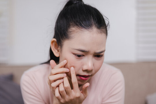 Close-up of teenage girl touching acne on cheek, upset expression, skincare and health care concept, puberty skin problem, beauty and healing.
