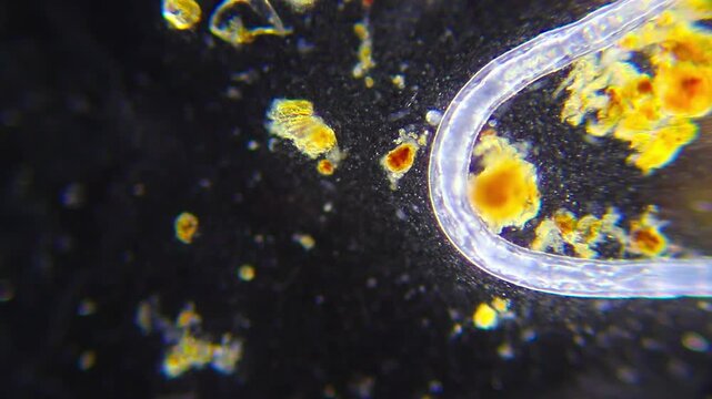Large worm crawling among numerous bacteria and ciliates with visible sand grains under 100x darkfield microscopy. Detailed 4k microscopic view of micro ecosystem