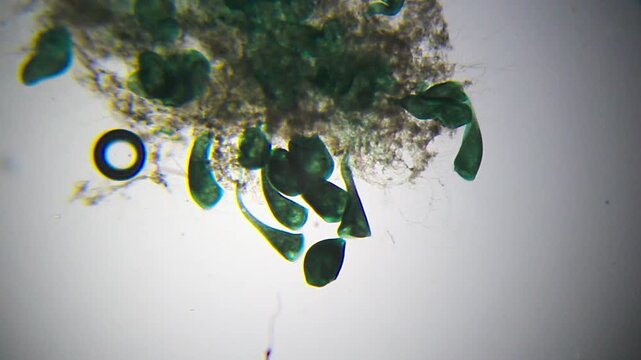 Stentor colony feeding under 40x brightfield microscopy with visible oral funnel and cilia