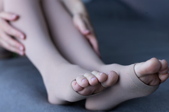 Woman wearing Medical Compression stockings for varicose veins and venouse therapy. 