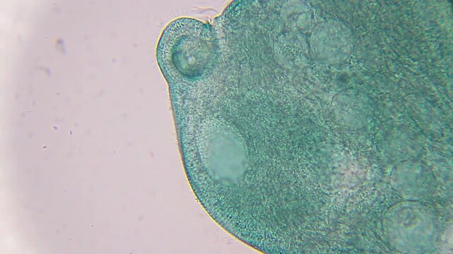Stentor ciliate under 400x brightfield microscopy with visible oral funnel and cilia