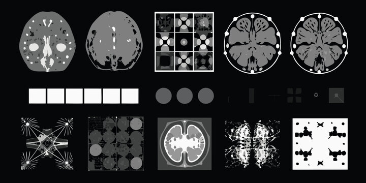 Medical imaging scans displaying axial brain views and related data visualizations