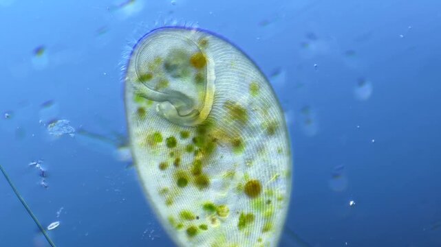 Giant Stentor Cell under the Microscope at 100 magnification