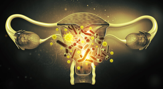 3D Anatomical Render of Viral and Bacterial Pathogens Affecting the Human Uterus