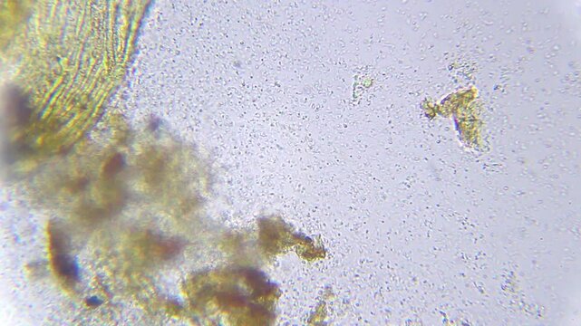 Large colony of bacteria killed by essential oil with a few surviving resistant cells under 400x brightfield microscopy. Detailed 4k microscopic view of antimicrobial effect.