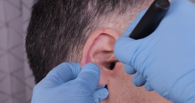 Close-up of a doctor removing earwax from a male patient&rsquo;s ear using a medical instrument. ENT care, hygiene, and professional healthcare procedure concept.