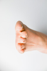 巻き爪・陥入爪の症状が出ている足の爪