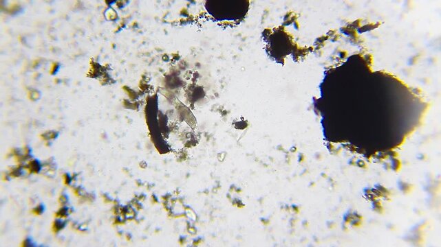 Rotifer moving among sand particles under 100x brightfield microscopy. 4K scientific microscopy footage showing invertebrate locomotion in particulate environment.